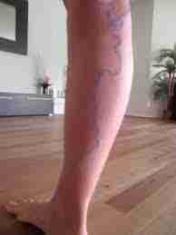 Lutter contre la cellulite au naturel