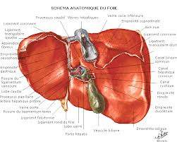 Rupture de varices œsophagiennes